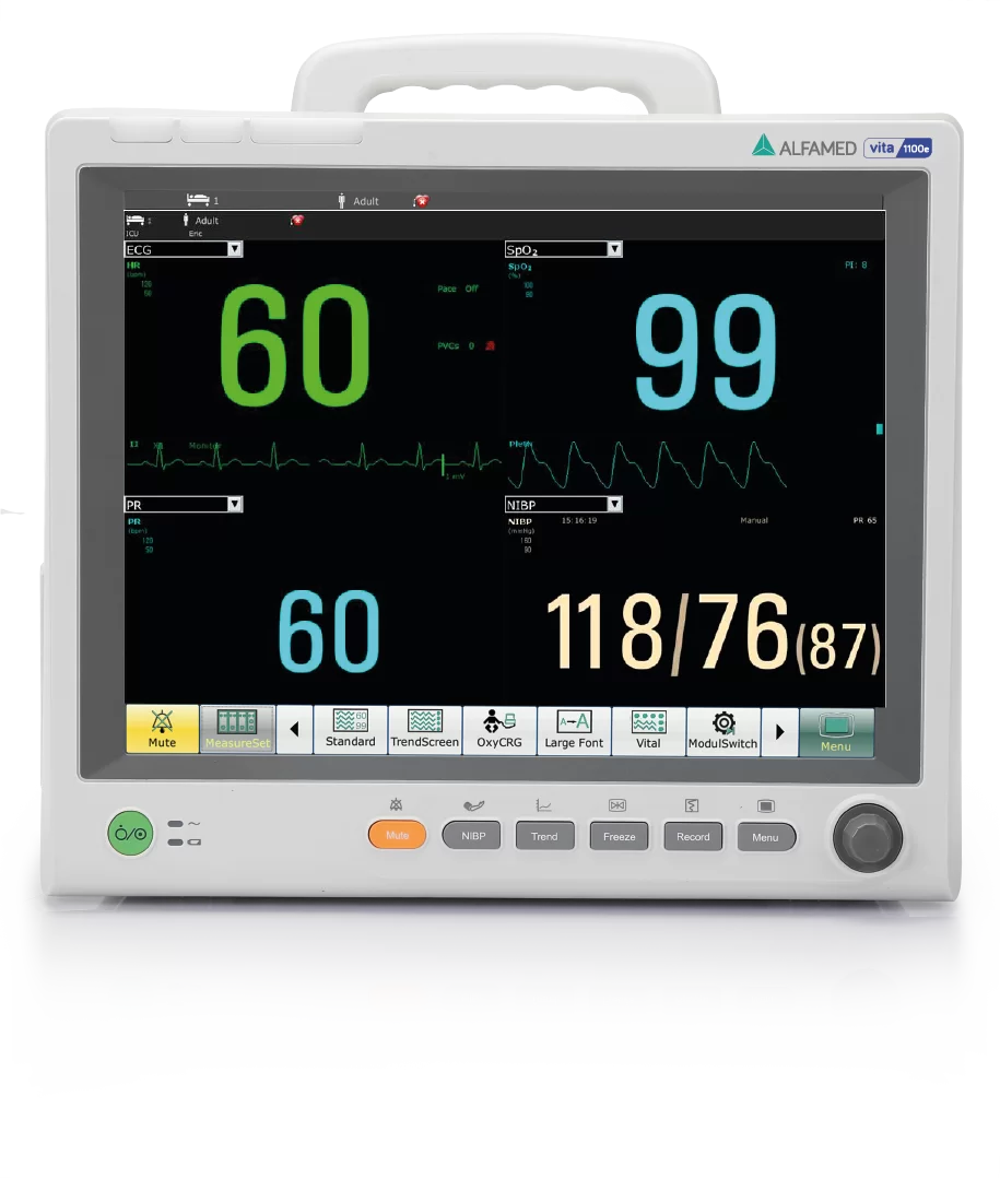 Monitor multiparâmetros Alfamed Vita 1100e — MADP MG